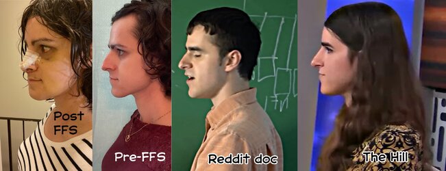 tony-profile-comparisons.jpg