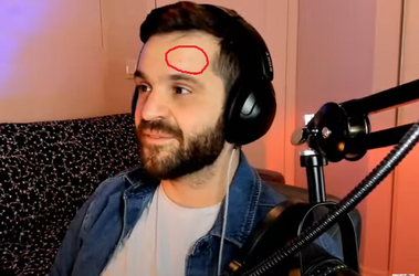 denthead3.png