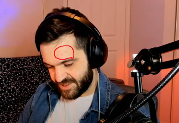 denthead1.png