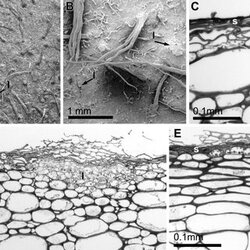 Kiwifruit-with-a-type-2-skin-rough-hairy-surface-composed-of-layers-of-dead-cells-A_Q320.jpg