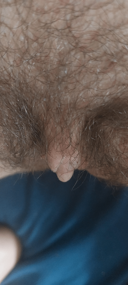 vdu0yuyvbp2a1.png