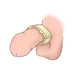Penis_clamp.png