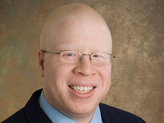 black albino.jpg