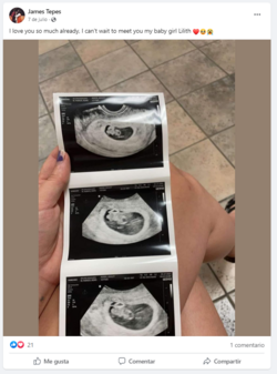 Ultrasound.png