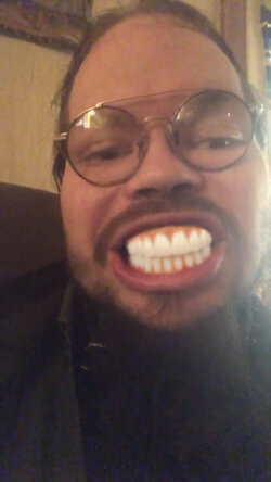 cobesnewteeth.jpg