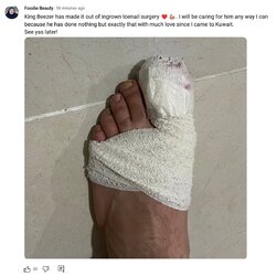 toe.jpg