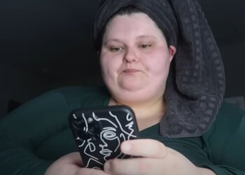 Discoloration.JPG