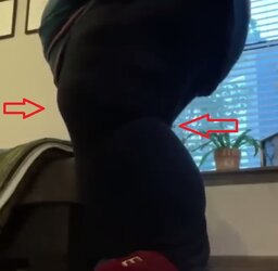 ALRknee.jpg