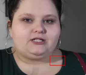 WEIGHT LOSS SURGERY, QUITTING OUTPATIENT, ADHD, ANXIETY, & MORE_ _ LIFE UPDATE 7-34 screenshot.png