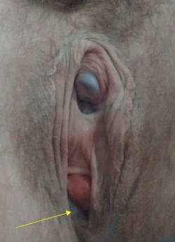 q3k5pem4kxda1.png