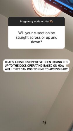 c-section.jpeg