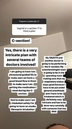 c-section 2.jpeg