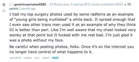 genericusername4582-mastectomyphotos.png