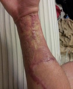 9 weeks - bottom.jpg