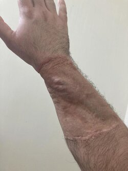 9.5 years - top.jpg