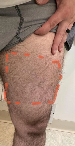 9be0ijrmhwba1.jpg