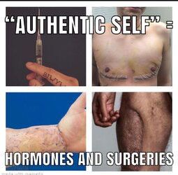 Scars.jpg