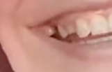 Melted Molars 2.png