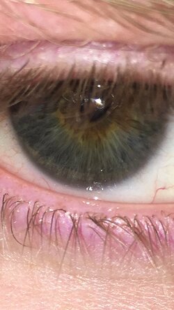 eye 2.jpg