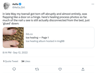 toenail2.png