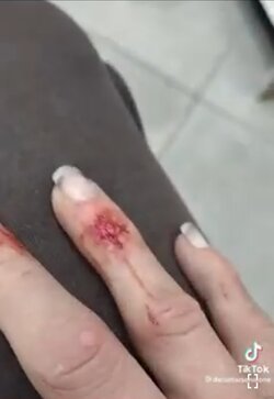 Nasty claws .jpg