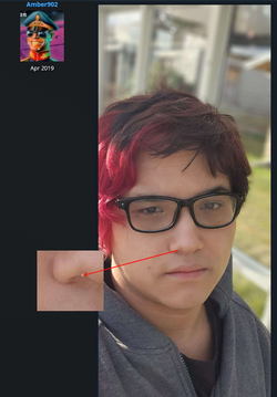 inj11.png