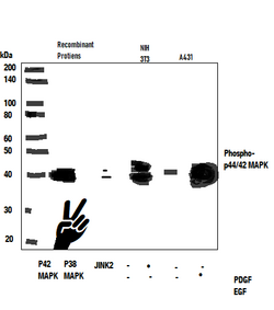 MAPK phosphatase.png
