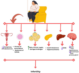 article_river_e4d715d0510911eda24c9934bf1e4650-20.10.2022-Rahnuma-Figure-1-female-infertility-.png