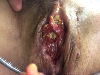 GRS-Revision-2015-03-28-at-09-17-42.jpg