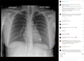Lav insta 3 day hospital stay.PNG