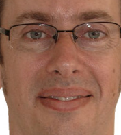 pros1.png
