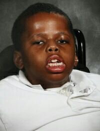 downs syndrome black kid.jpg