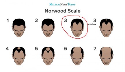 norwood.jpg