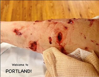welcome to portland pibble attack.jpg