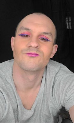 Bald retard.PNG