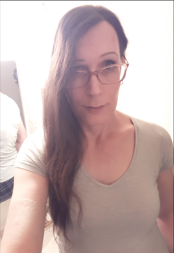 Forehead Nigga.PNG