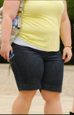 obese 1.png