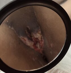 im-extremely-disappointed-with-my-vaginoplasty-result-v0-pwgui0vtwcxa1 (1).jpg