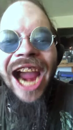CobraTeeth572023.jpg