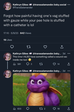 wound vac.jpg
