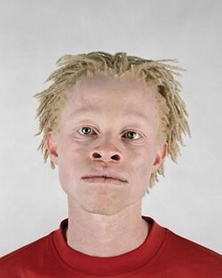 Mar06-albino_african_americans.jpg