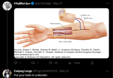blue check brain rot 2.PNG blue check brain rot 2.PNG