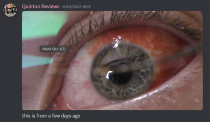 sick II 15.png
