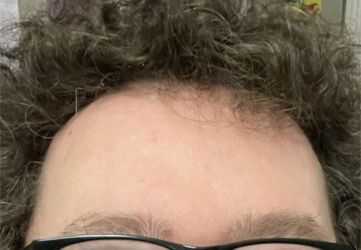 1000006314.png