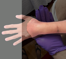 armskin.png