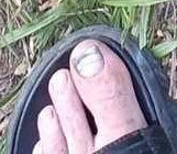 IMG_3921toe.jpg