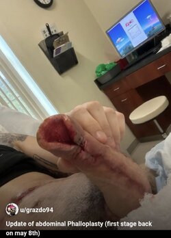 splay penis 2.jpg