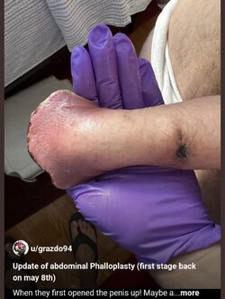 splay penis.jpg