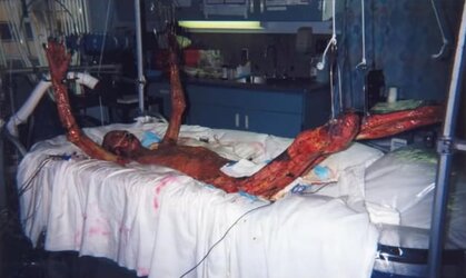 the-most-radioactive-person-hisashi-ouchi-83-days-of-hell-v0-yejgqb7ov2aa1.jpg