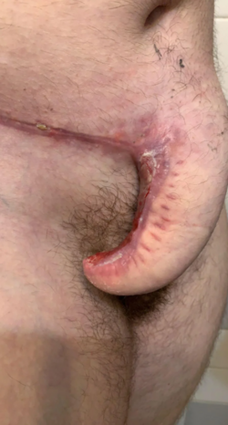 ElephantDick4.png